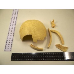 Anatomie: os crânien