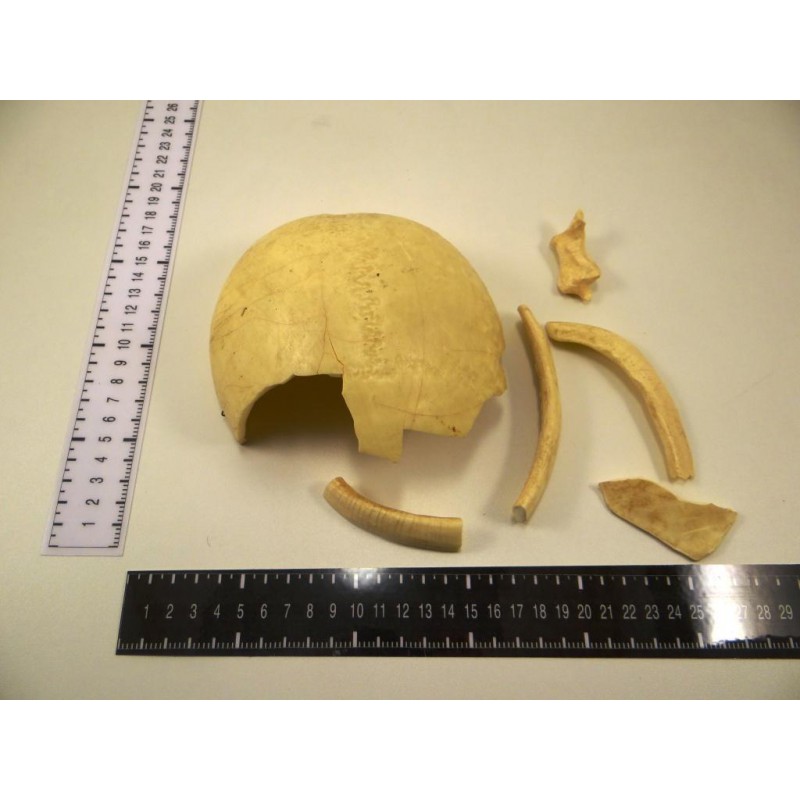 Anatomie: os crânien